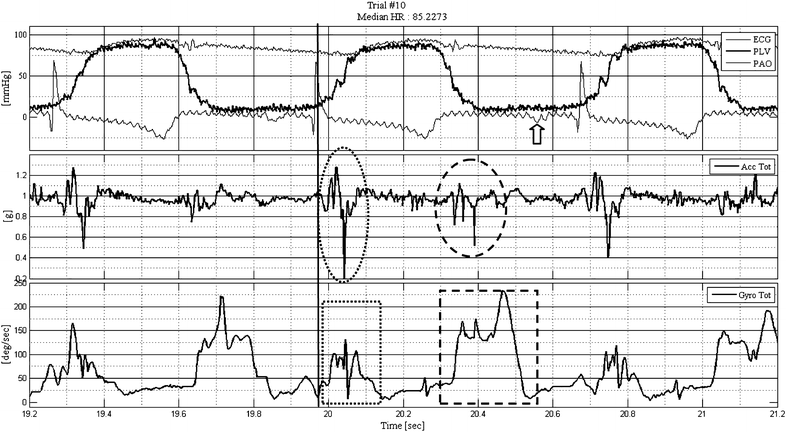 Fig. 3