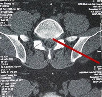 Fig. 2