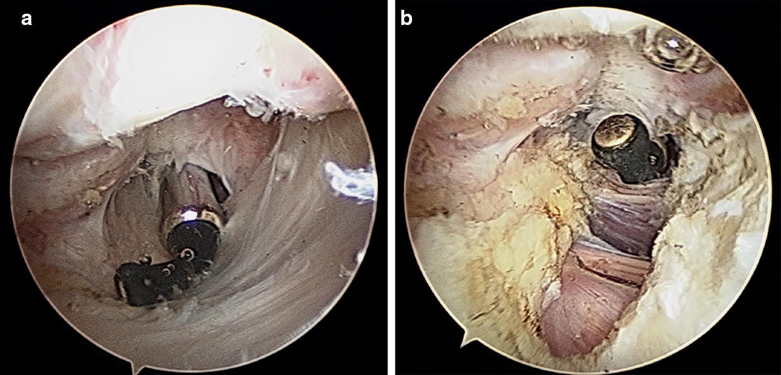 Fig. 1