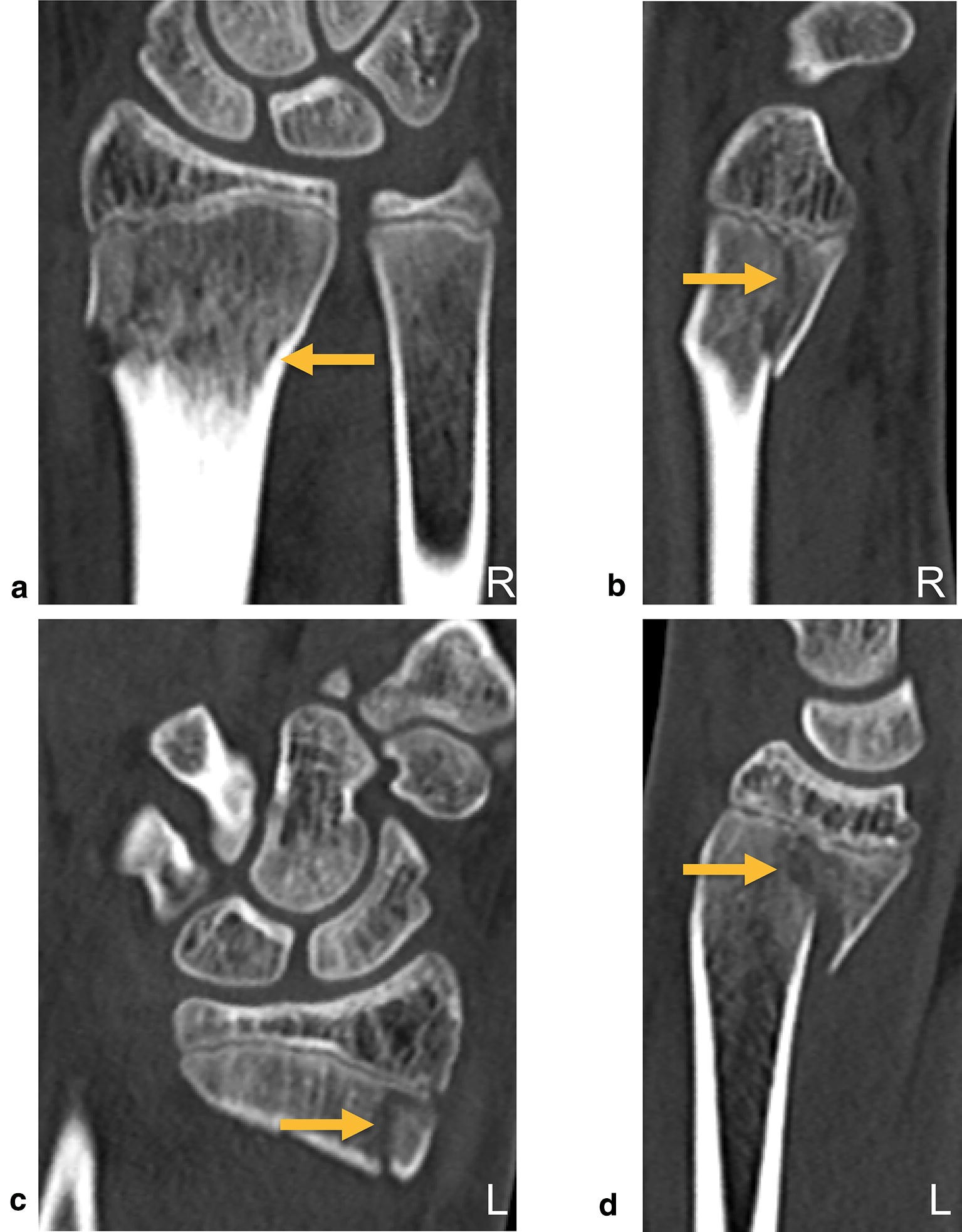 Fig. 3