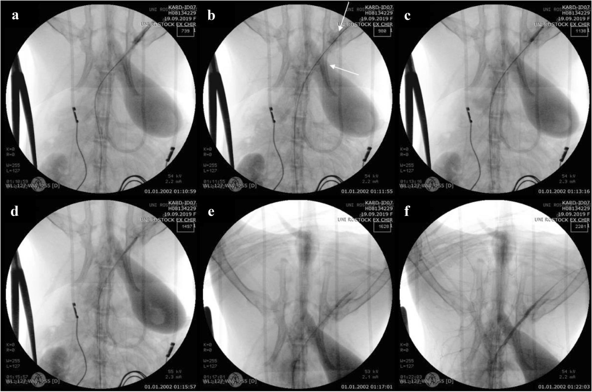 Fig. 3