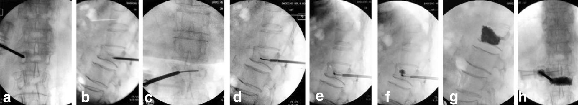 Fig. 2