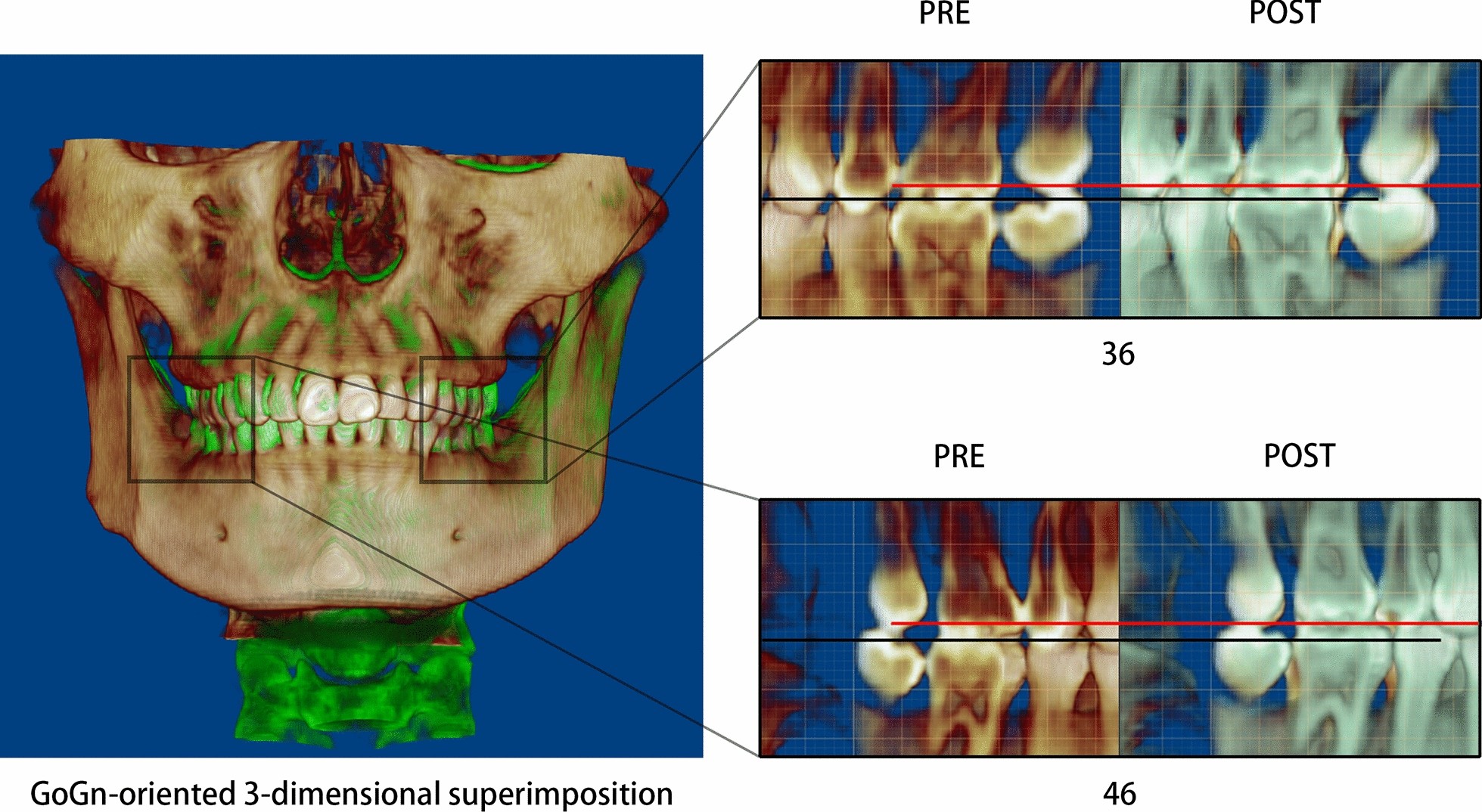 Fig. 11