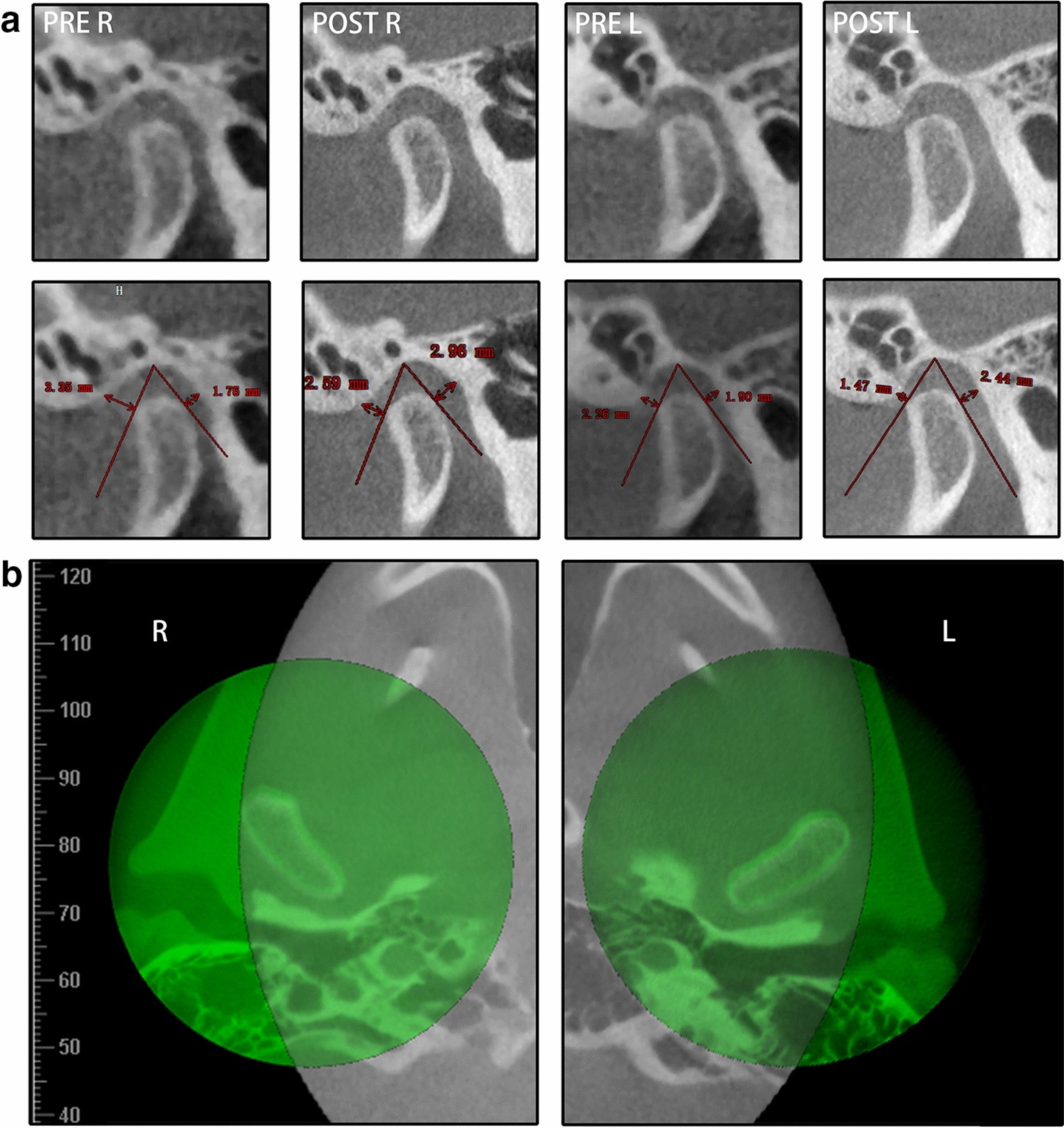 Fig. 12