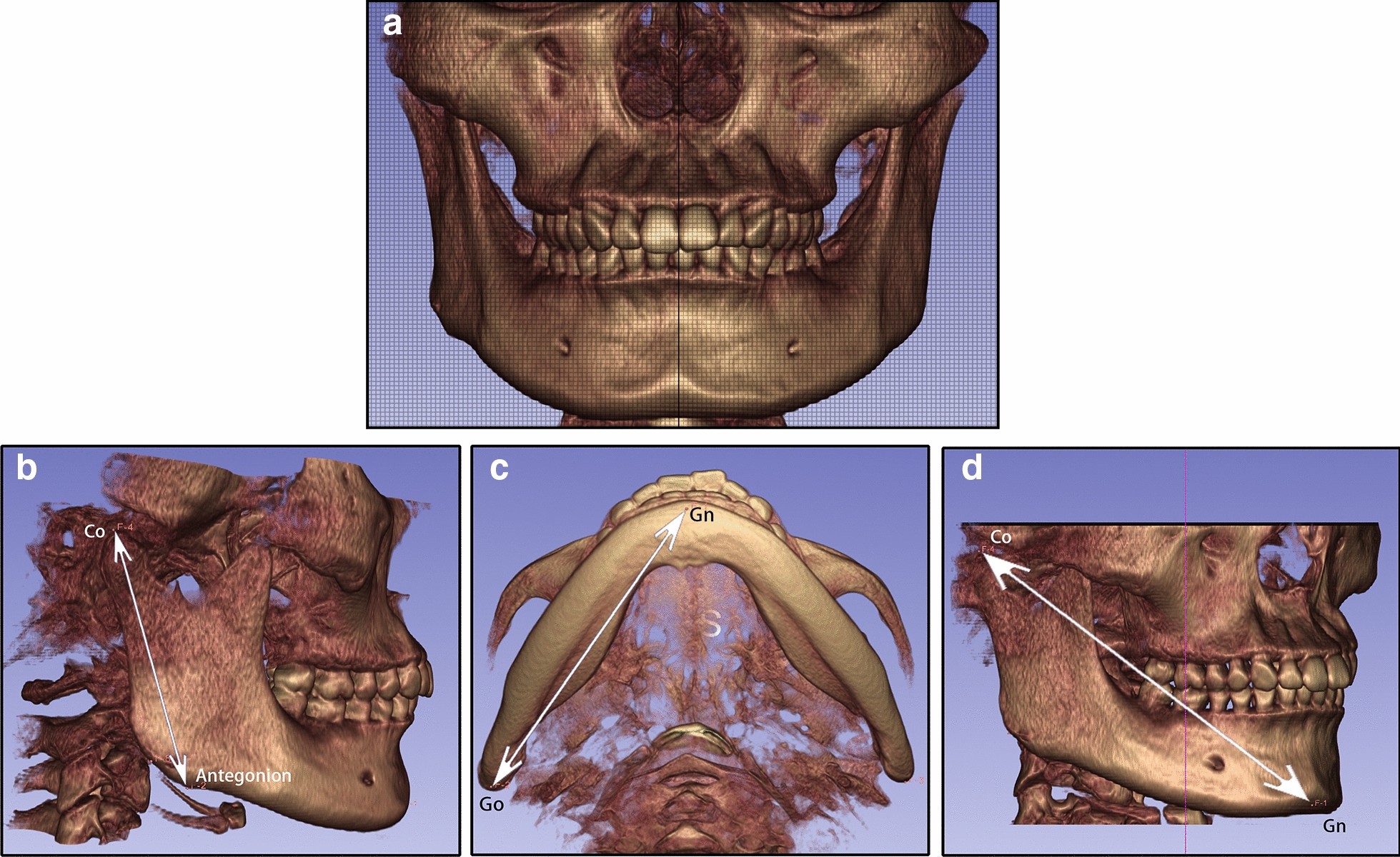 Fig. 4