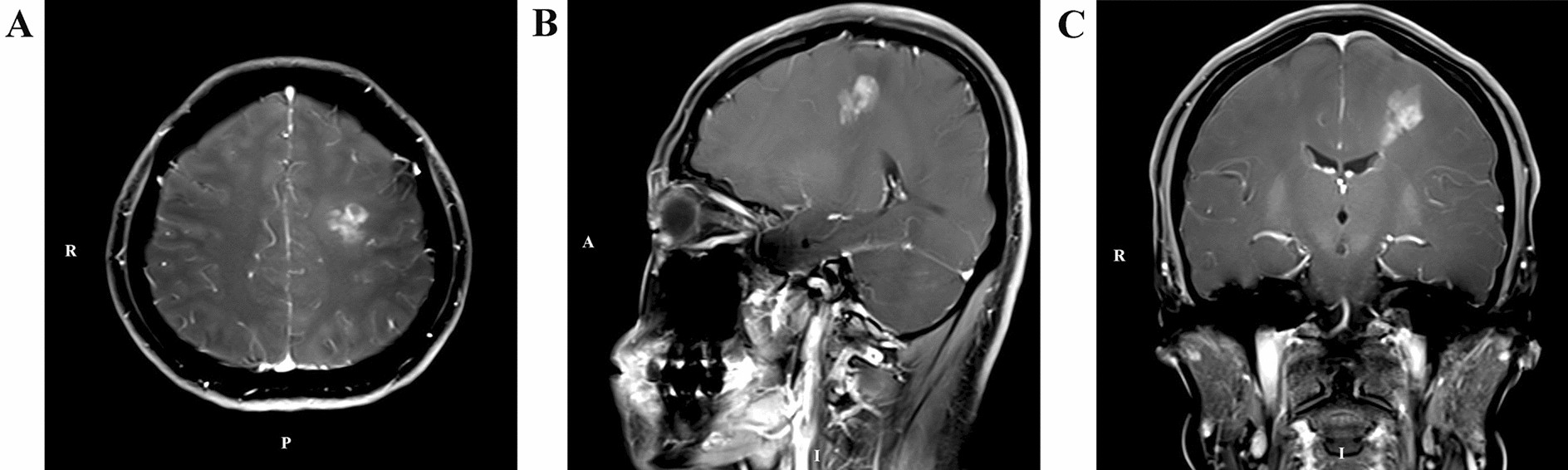 Fig. 2