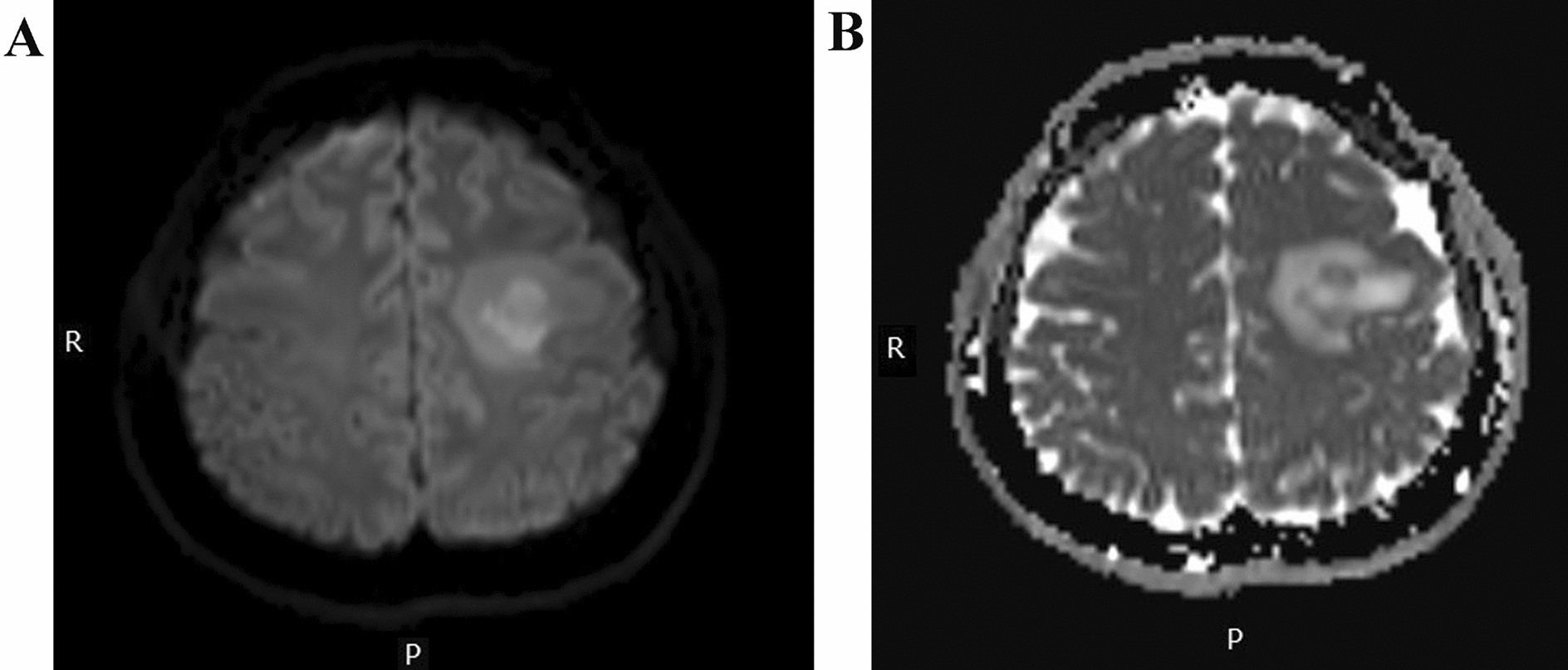 Fig. 4