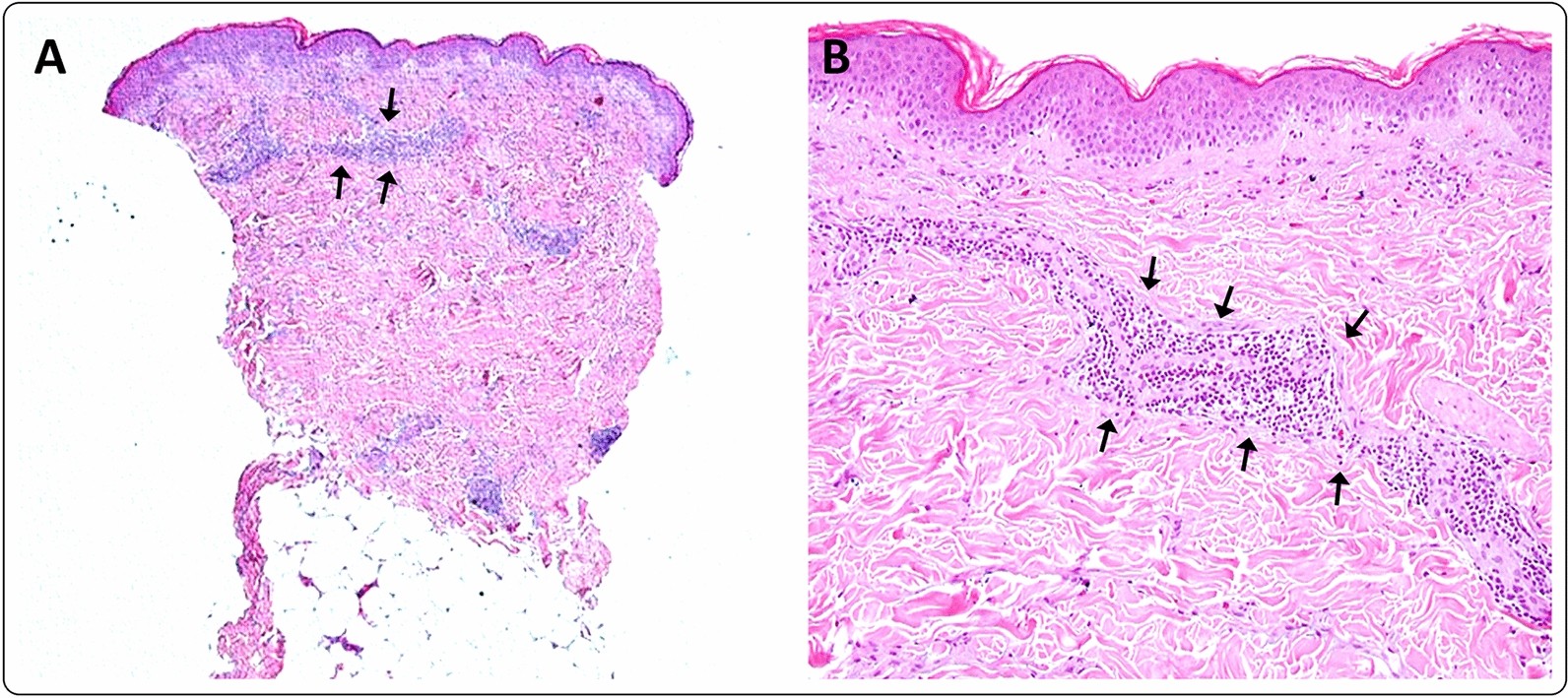 Fig. 10