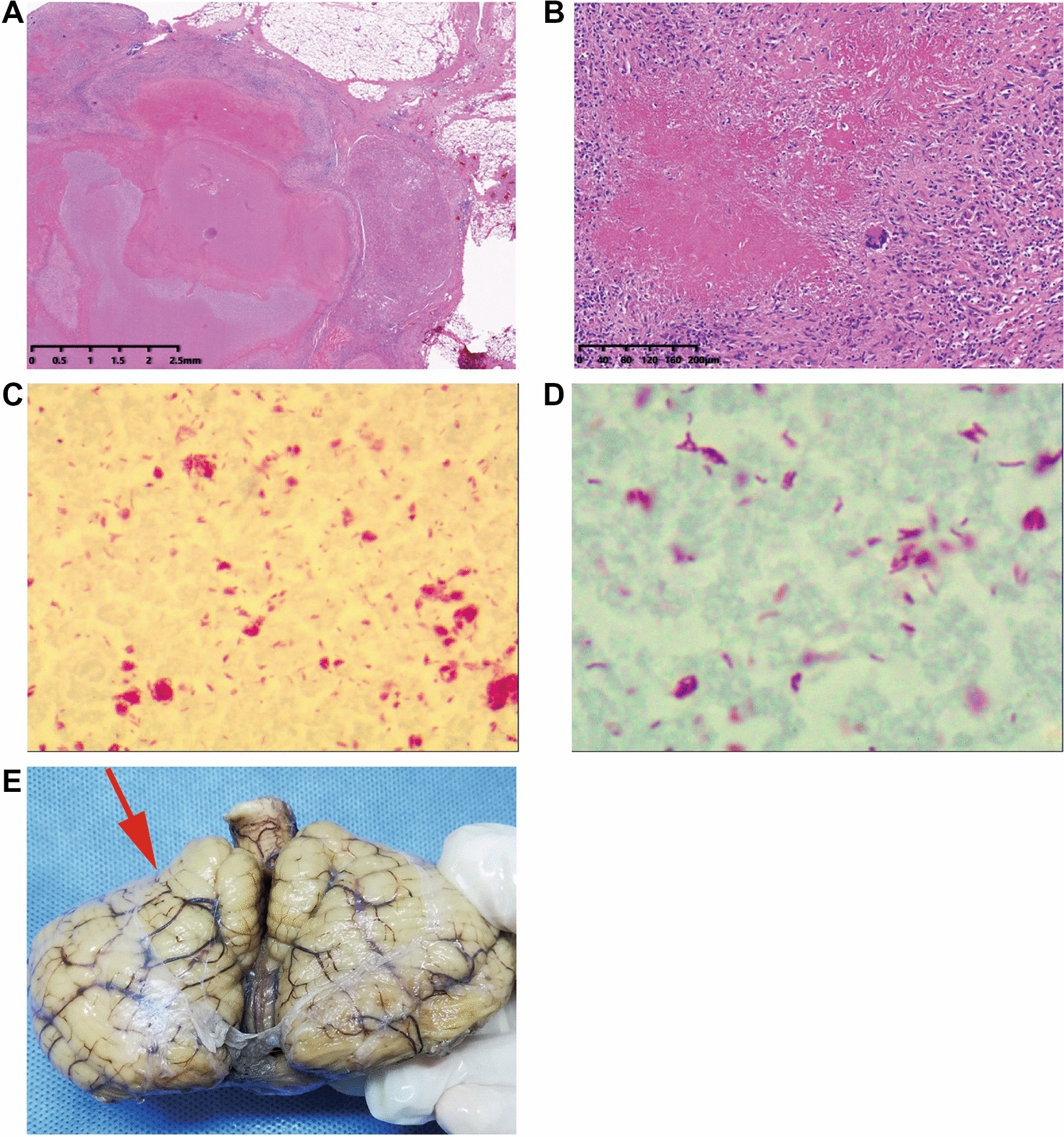 Fig.2