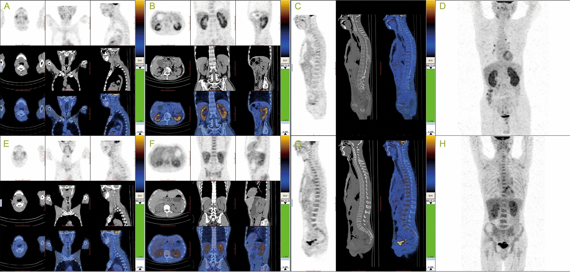 Fig.2