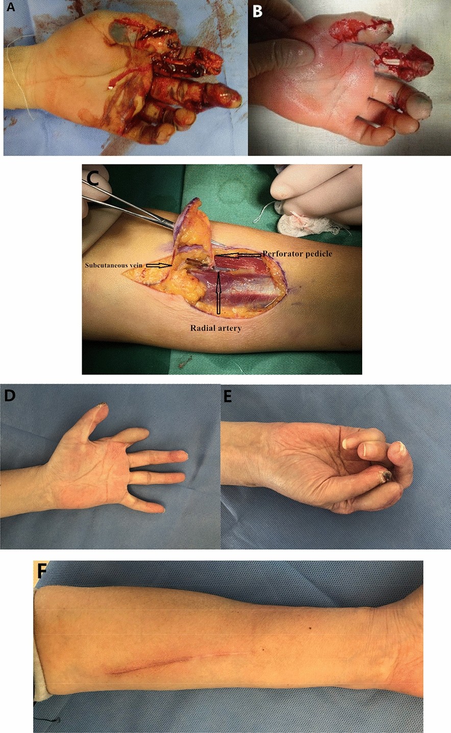 Fig.4