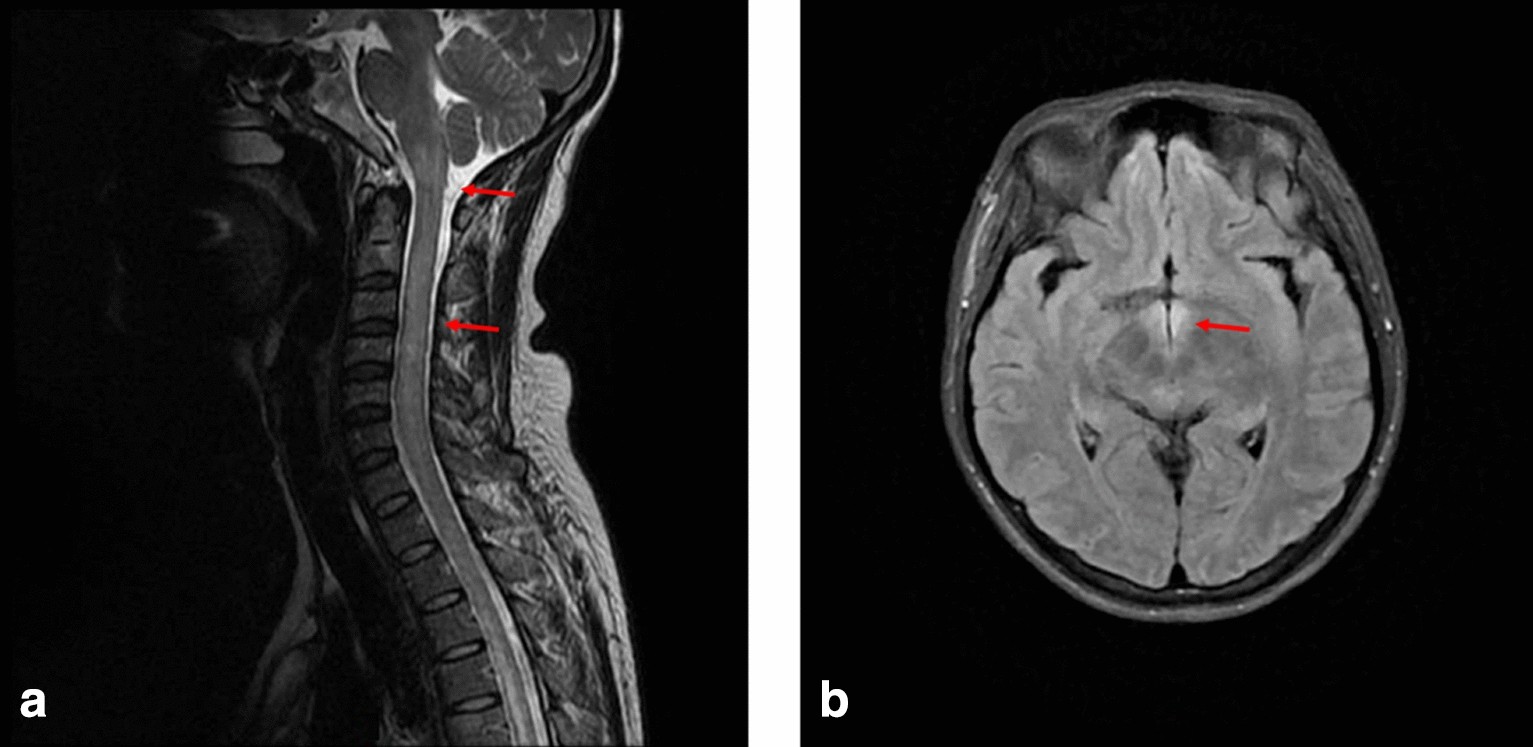 Fig. 1