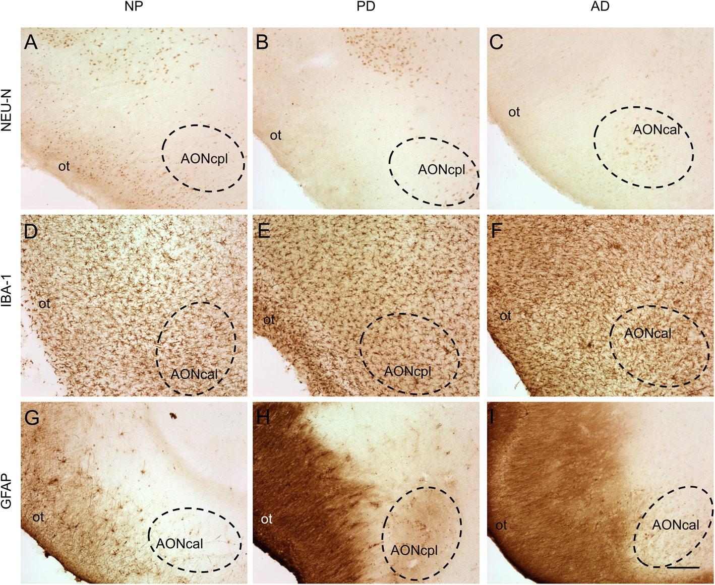 Fig. 11