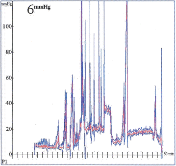 Fig. 2