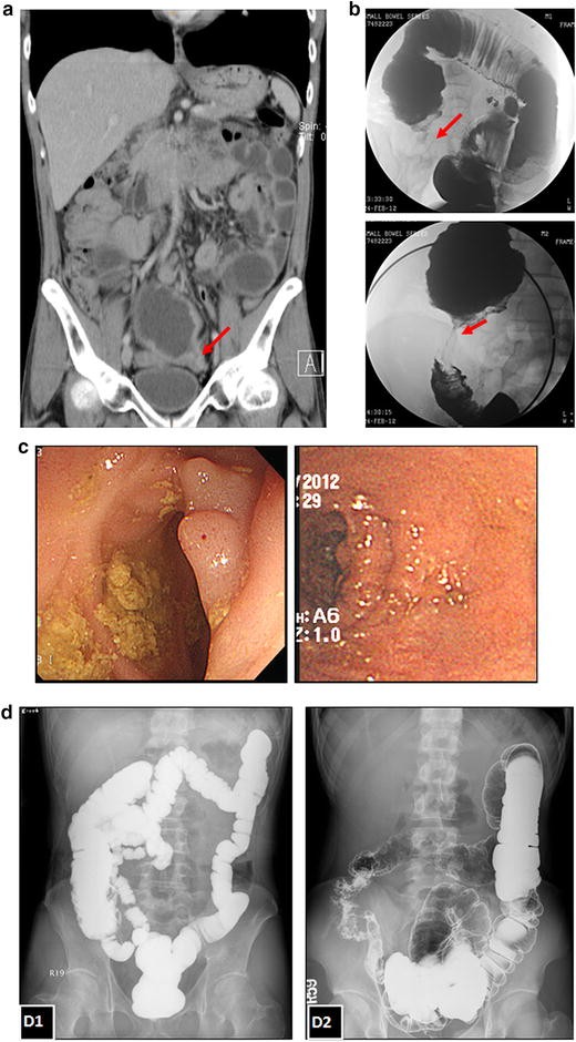 Figure 1