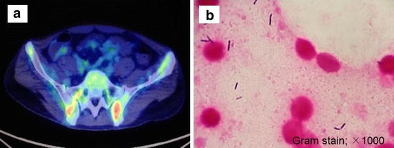 Fig. 1