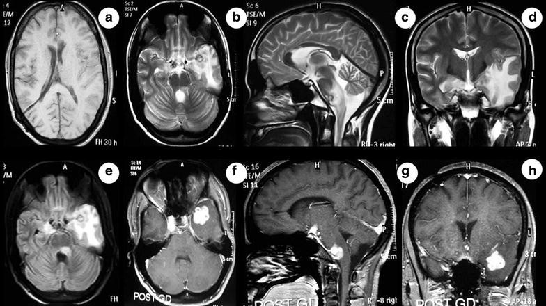 Fig. 1