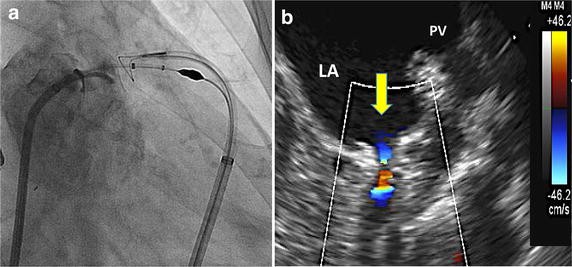 Fig. 4