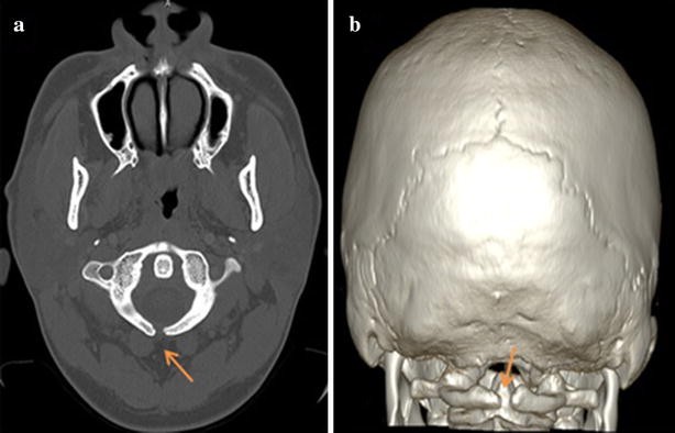 Fig. 2