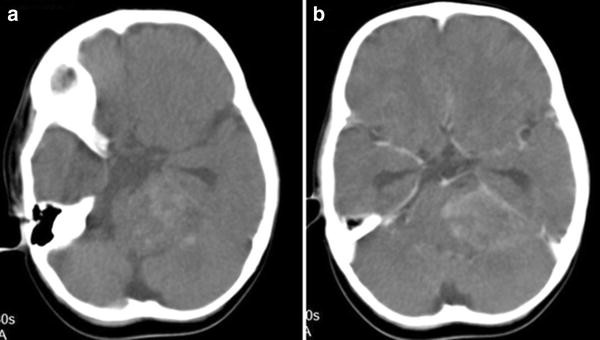 Fig. 1