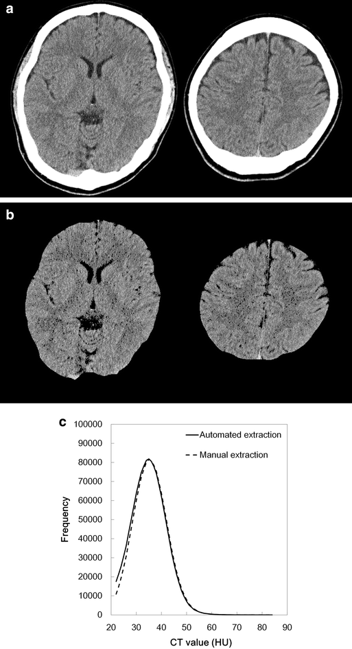 Fig. 4