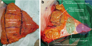 Fig. 2