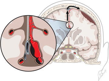 Fig. 4