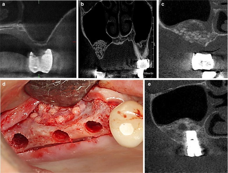 Fig. 1