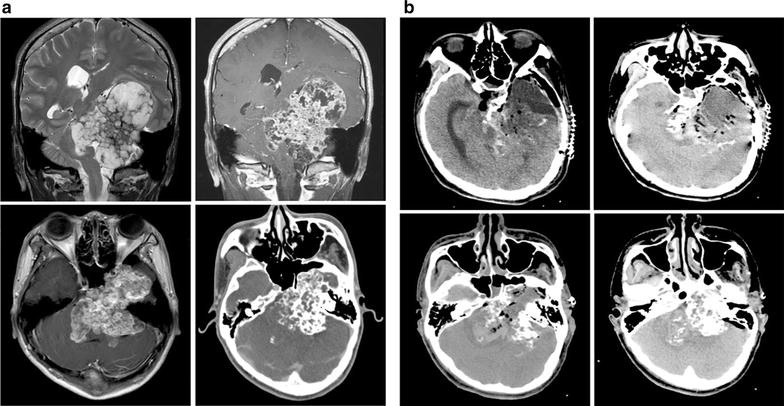 Fig. 1