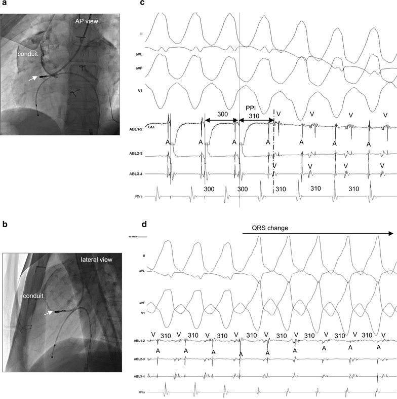 Fig. 3