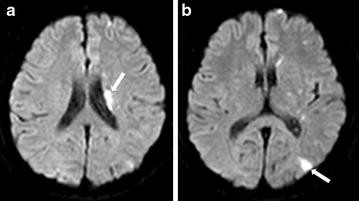 Fig. 1