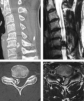 Fig. 2