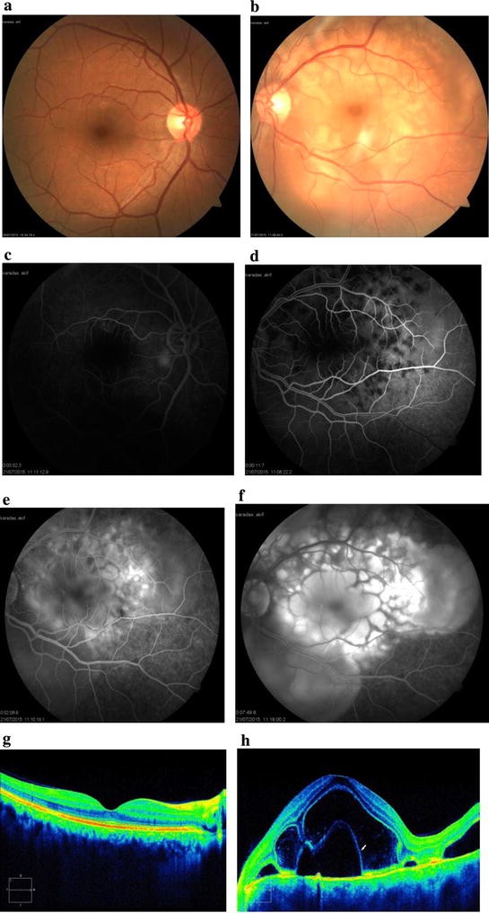 Fig. 1