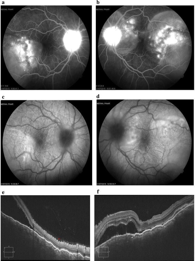 Fig. 5