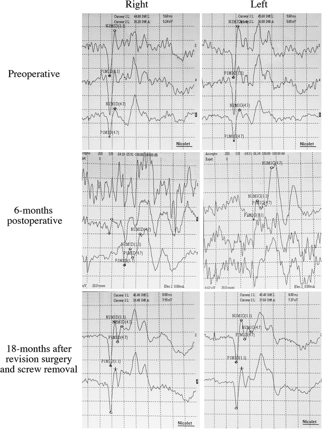 Fig. 4