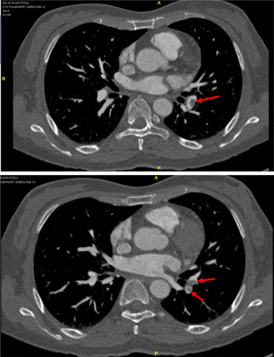 Fig. 1