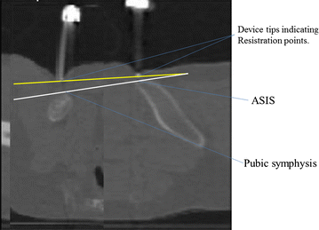 Fig. 3