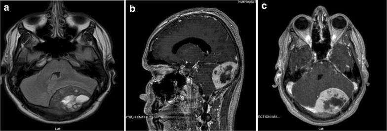 Fig. 1