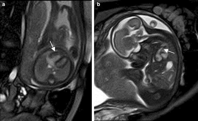 Fig. 21