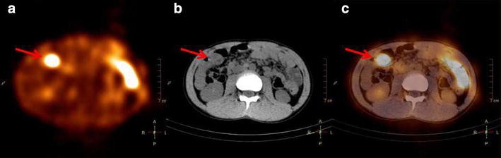 Fig. 3