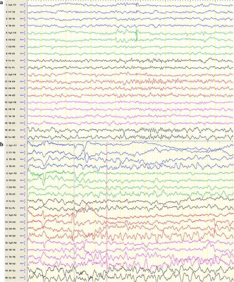 Fig. 2