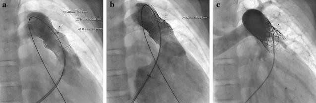 Fig. 2