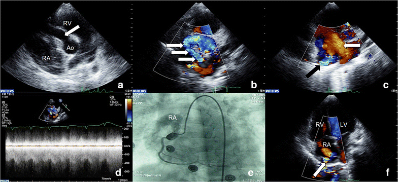 Fig. 3