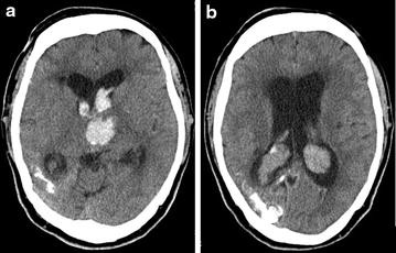 Fig. 1