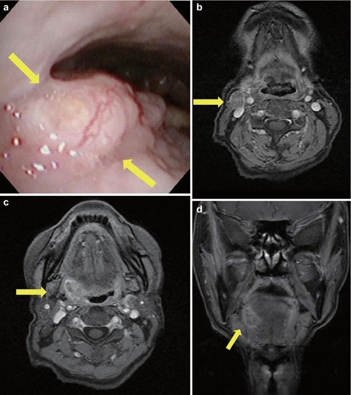 Fig. 1