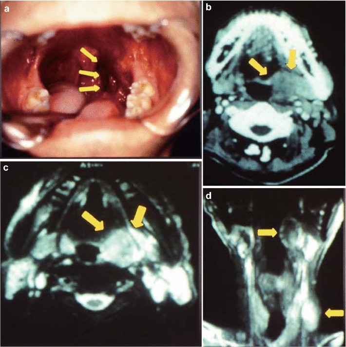 Fig. 2