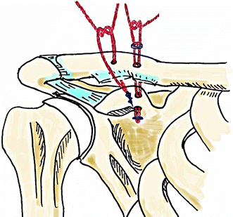 Fig. 2