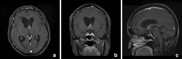 Fig. 2