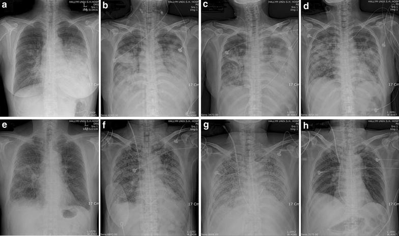 Fig. 1