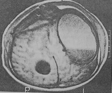 Fig. 14